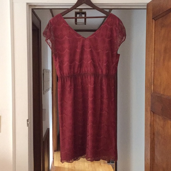 Fossil lace mini dress - Picture 5 of 5